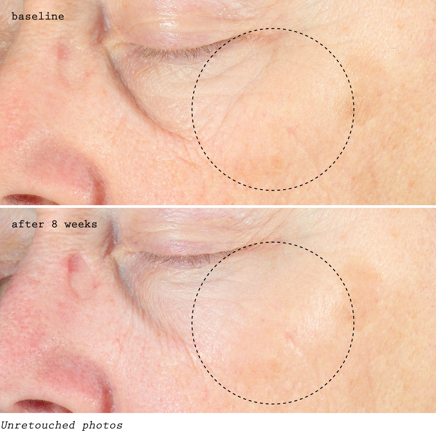 LEVEL 3 – pH OPTIMUM RETINOL REPAIRING - 5000 IUs - Dr. Koo Private Practice