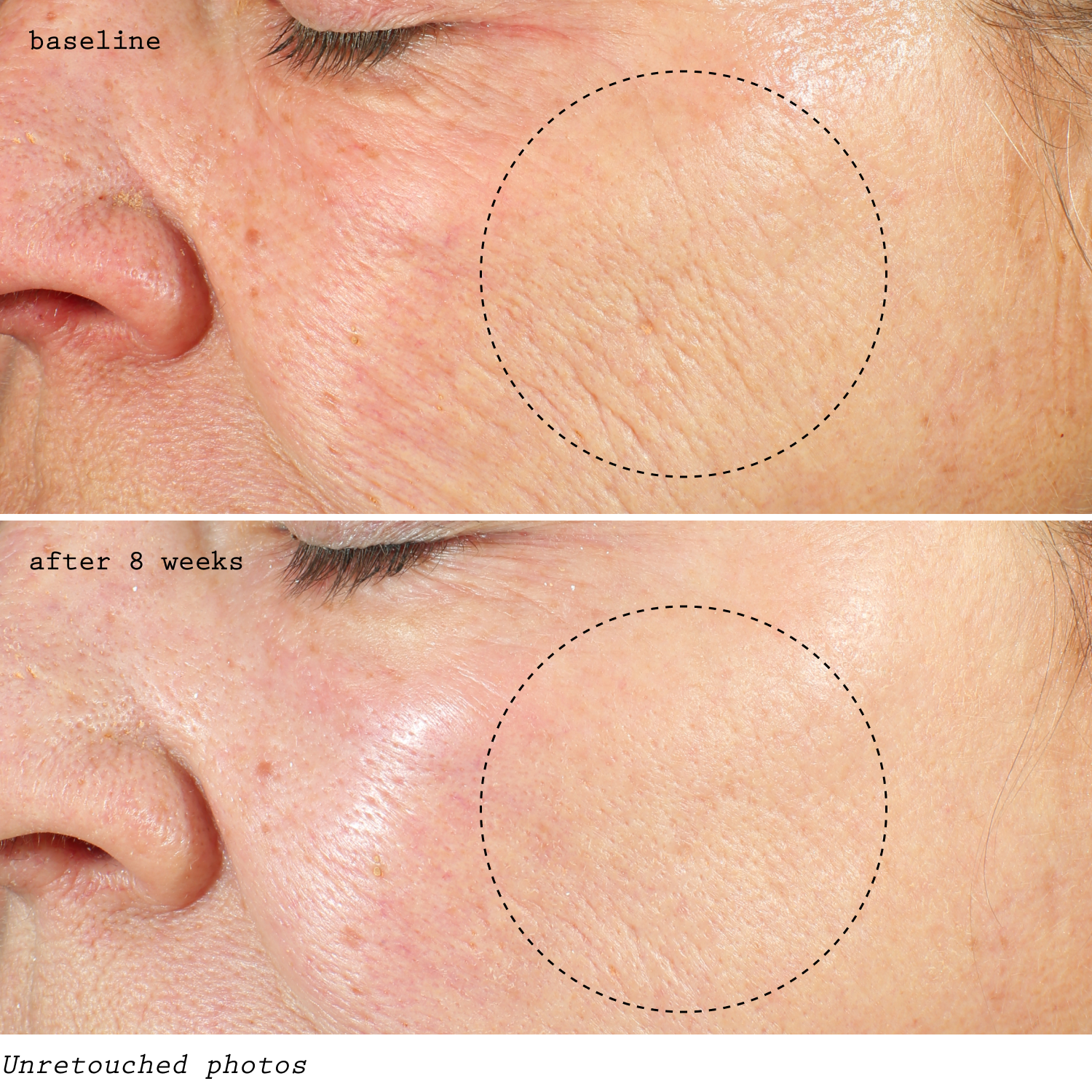 LEVEL 4 – pH OPTIMUM RETINOL RESTORING - 8000 IUs - Dr. Koo Private Practice