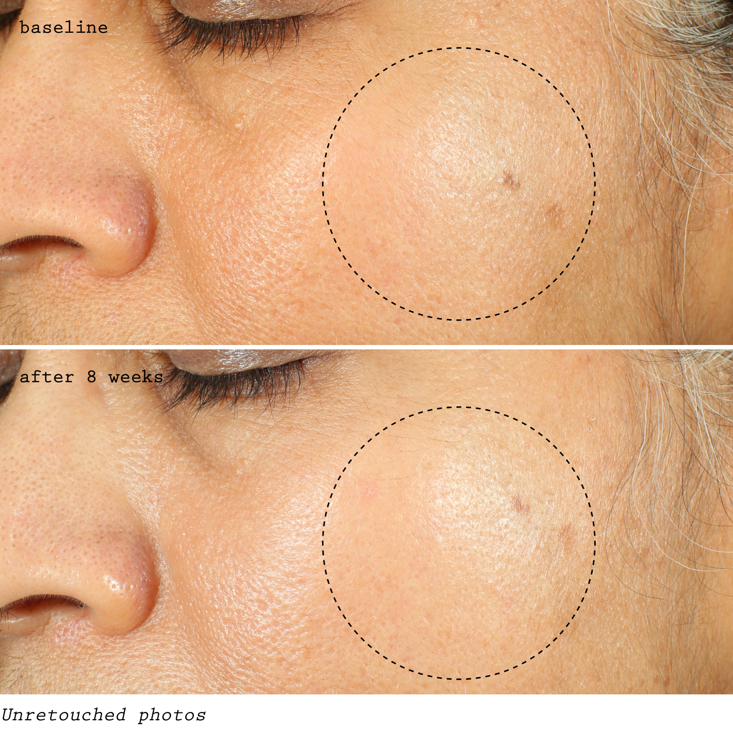 LEVEL 3 – pH OPTIMUM RETINOL REPAIRING - 5000 IUs - Dr. Koo Private Practice